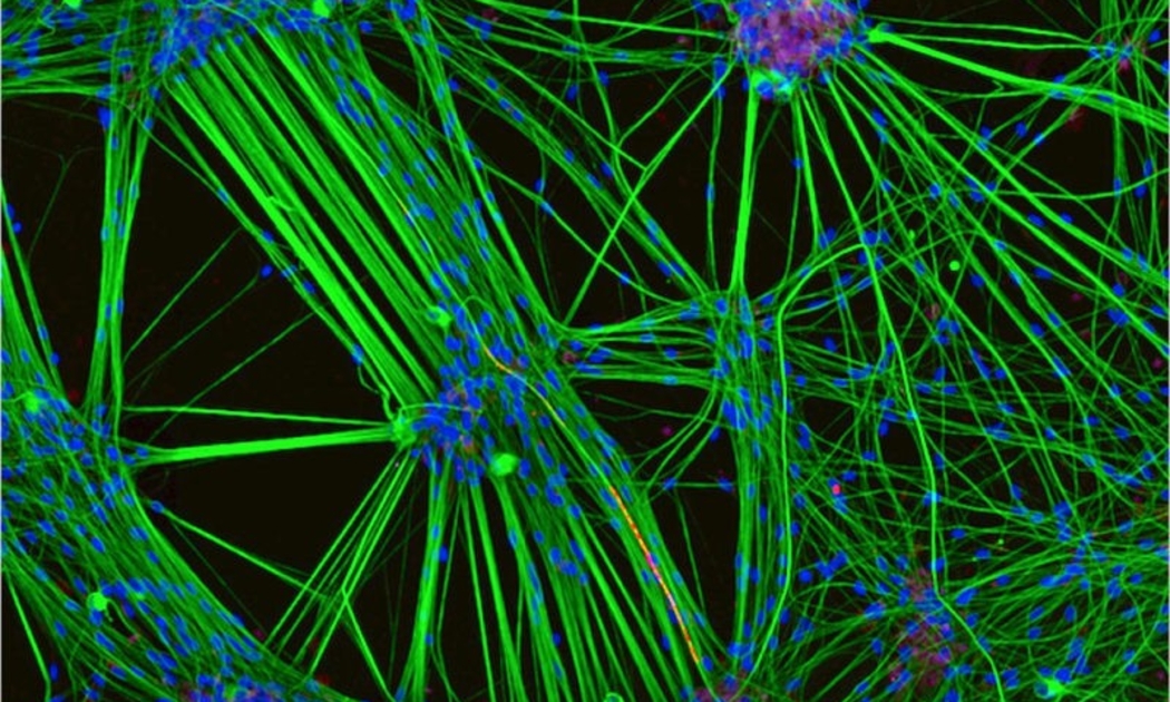 Các neuron người được nuôi cấy trong phòng thí nghiệm, hiển thị mạng lưới kết nối phức tạp giữa các tế bào thần kinh - nền tảng cho các nghiên cứu điện toán sinh học và công nghệ “wetware”. Nguồn: Nikon Small World/Leica Microsystems