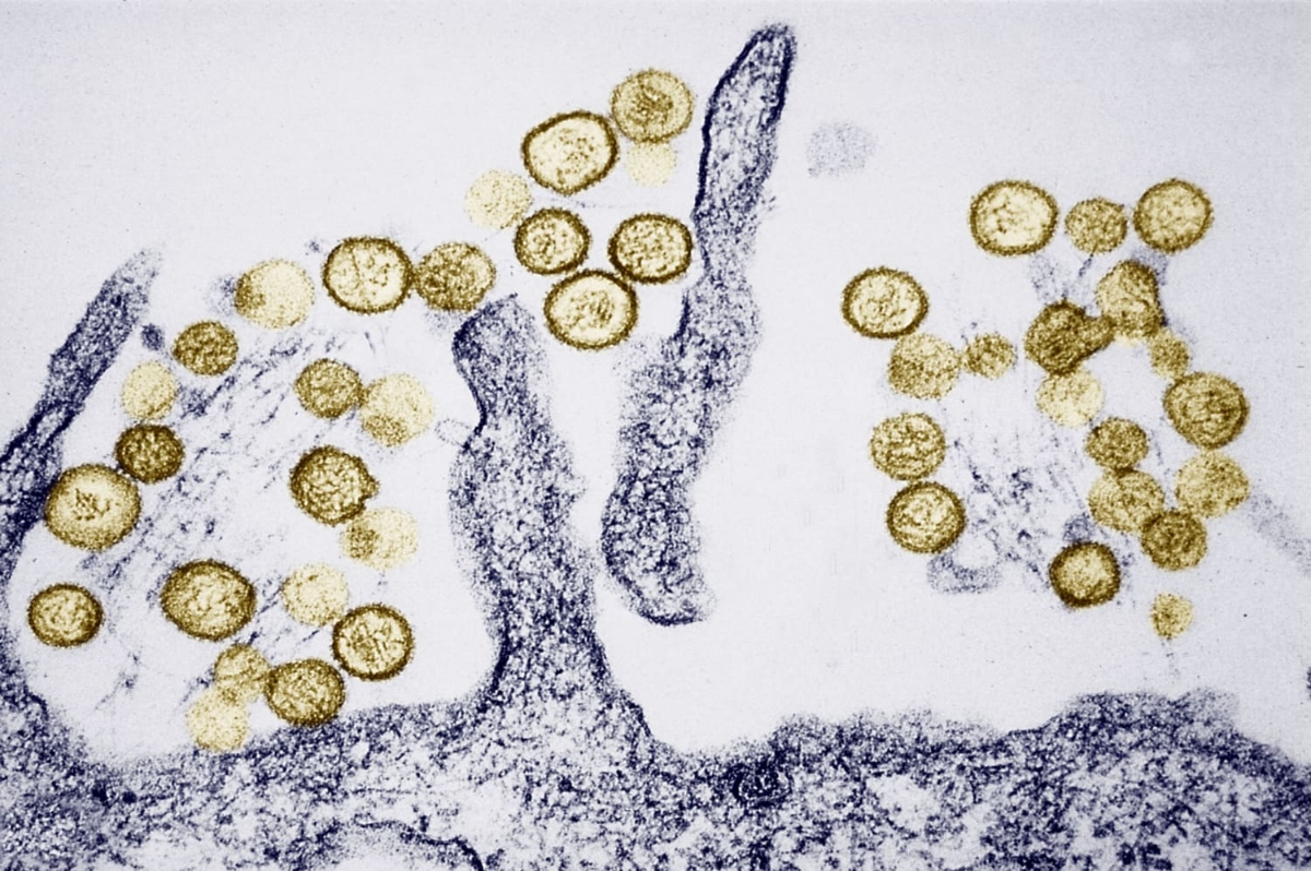 Hanta&nbsp;virus chủ yếu lây qua tiếp xúc hoặc hít phải bụi nhiễm phân, nước tiểu của loài gặm nhấm, đặc biệt là chuột.