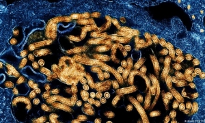 WHO báo động khẩn cấp quốc tế vì Ebola tái bùng phát tại châu Phi