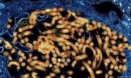Ebola, được cho là có nguồn gốc từ loài dơi, có thể gây xuất huyết nghiêm trọng và suy đa cơ quan. Ảnh: Mage Point FR
