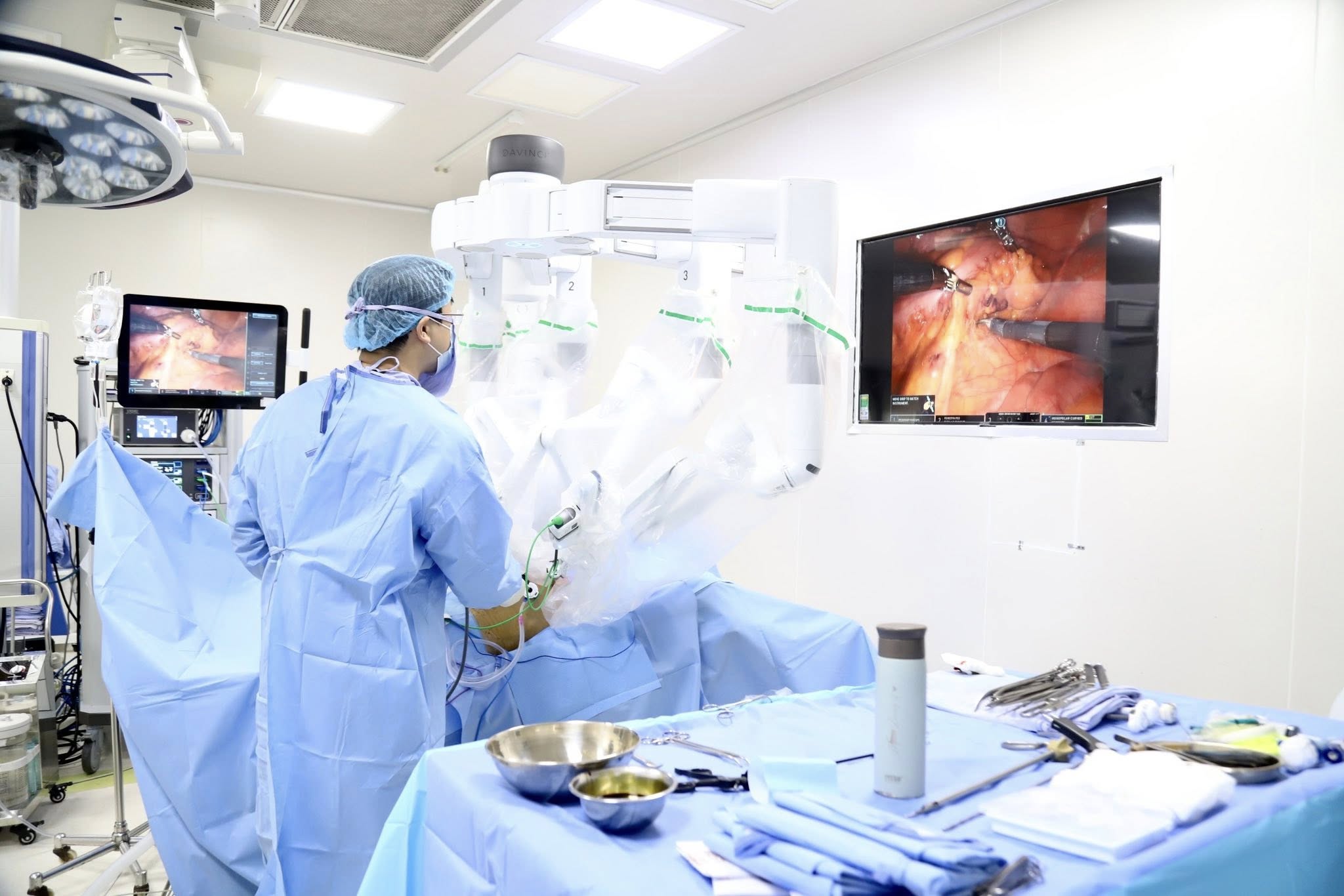 Các bác sĩ Bệnh viện K phẫu thuật nội soi robot cho người bệnh.