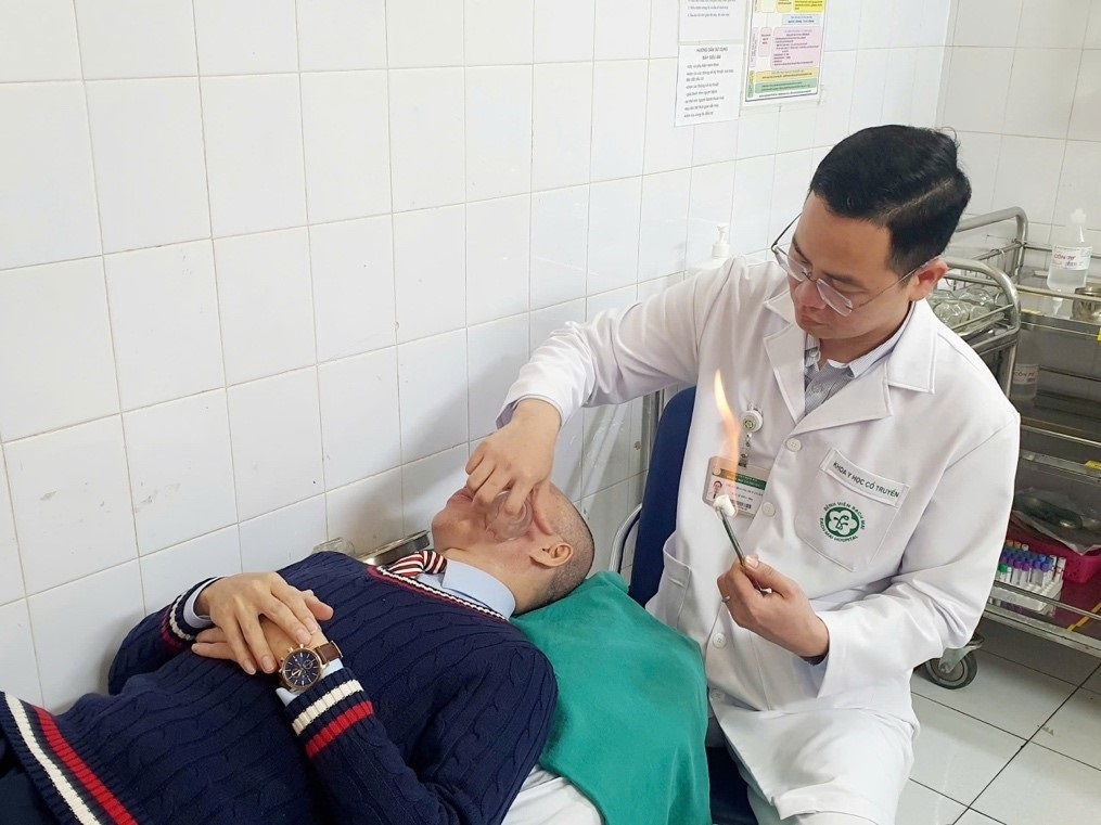 Giác hơi mặt phương pháp điều trị liệt mặt hiệu quả, với điều kiện được thực hiện đúng phác đồ tại cơ sở y tế.
