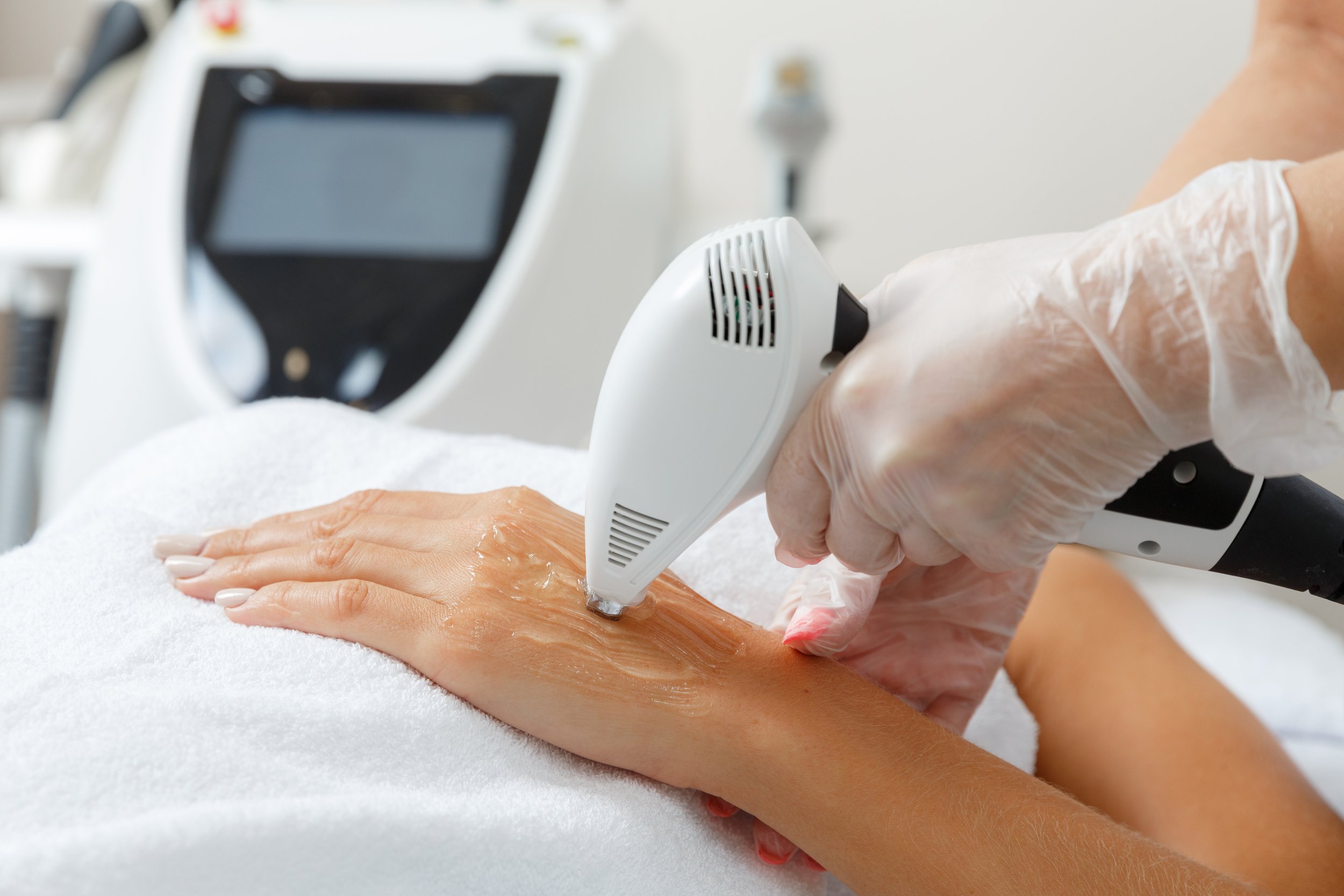 Nhiều phương pháp trẻ hóa da mặt hiện nay cũng có thể được áp dụng cho đôi tay.