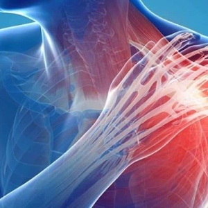 Các bệnh lý cơ xương khớp tạo ra áp lực rất lớn cho hệ thống y tế.