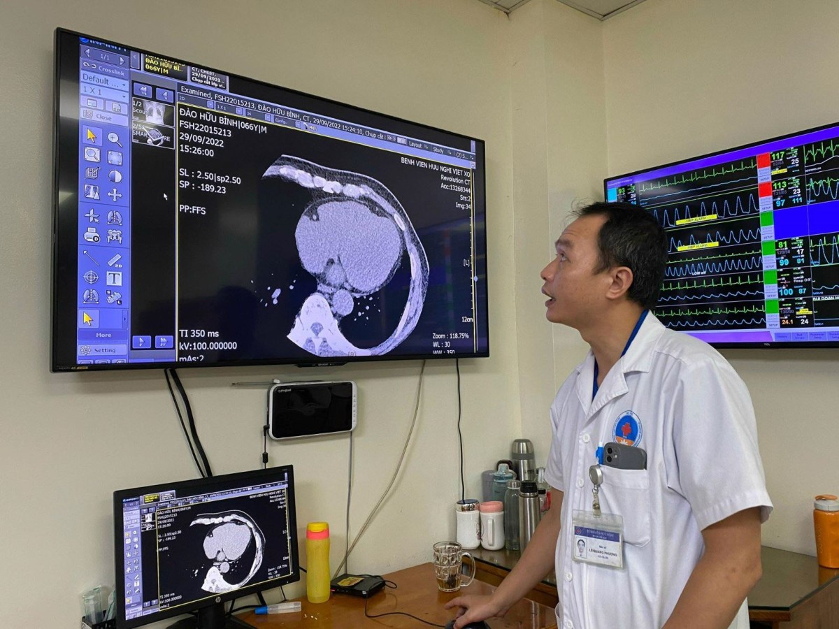 Bệnh án điện tử như "hệ thần kinh trung ương" của y tế hiện đại, là hạ tầng dữ liệu của ngành y tế. Ảnh: Bệnh viện Hữu Nghị