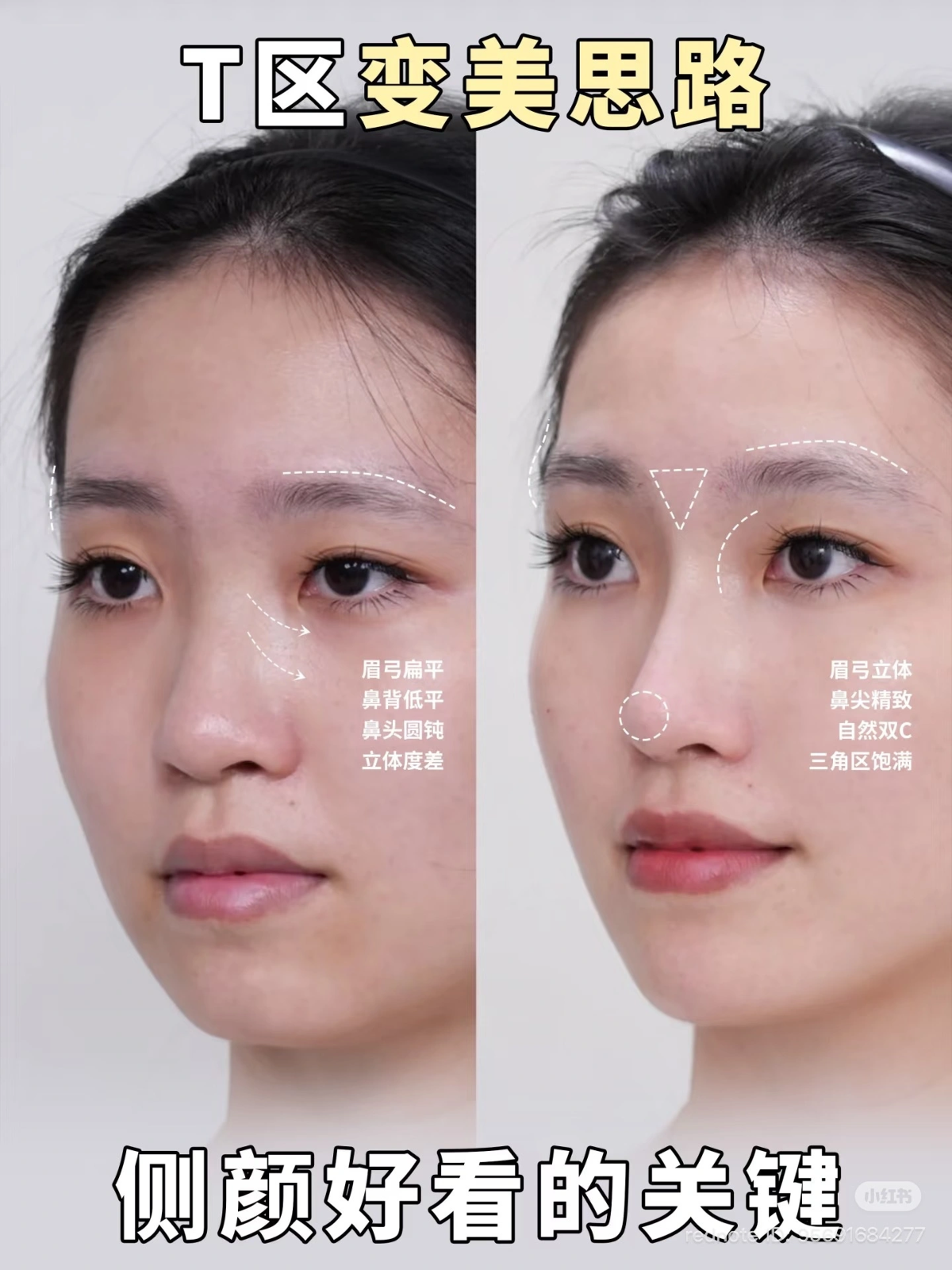 Ảnh: Xiaohongshu