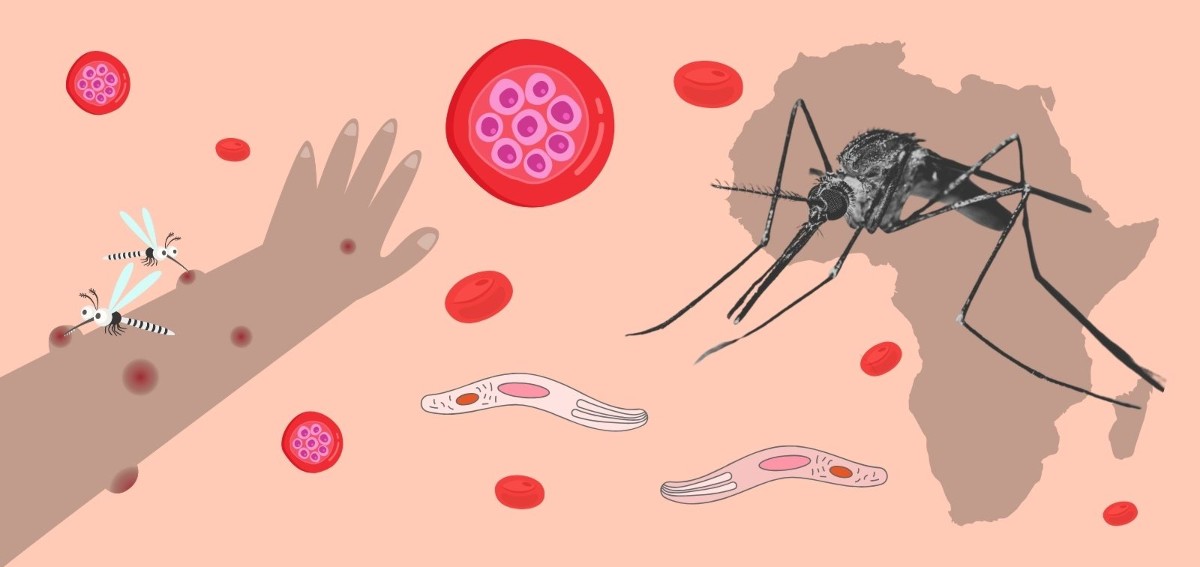 Theo Báo cáo Sốt rét Thế giới năm 2024, châu Phi chiếm khoảng 94% số ca mắc bệnh. Ảnh: IS Global