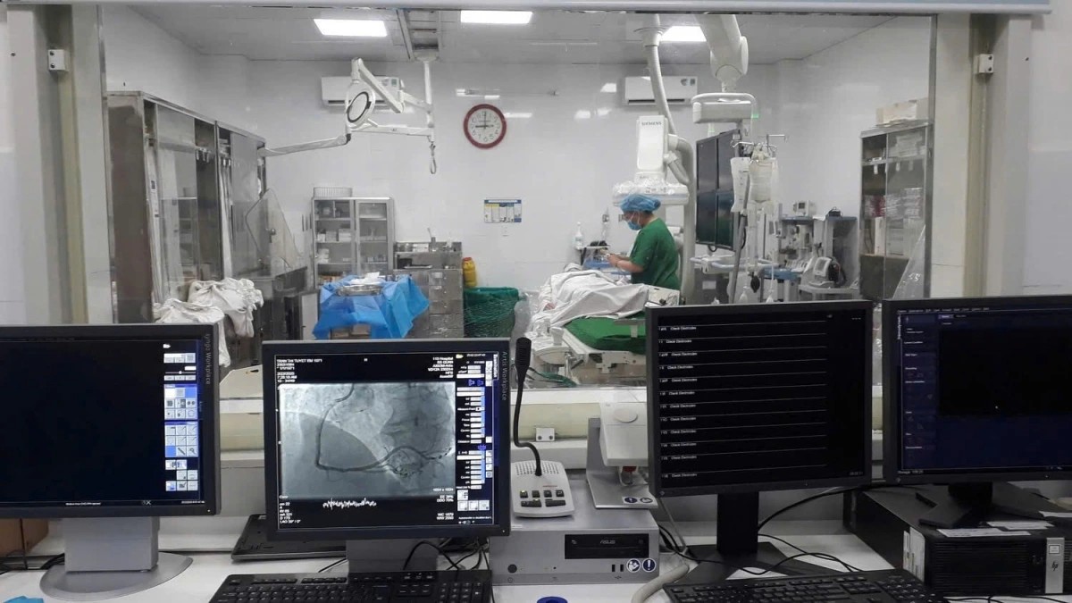 Hệ thông máy DSA chuẩn bị can thiếp lấy huyết khối cho bệnh nhân tắc mạch máu trong não. Ảnh: Bệnh viện Nhân dân 115