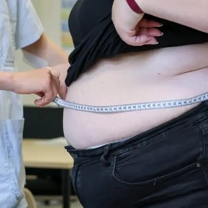 Theo một nghiên cứu mới, béo phì có thể là nguyên nhân của tới 1/10 số ca ung thư. Ảnh: Jan Woitas/dpa/picture alliance