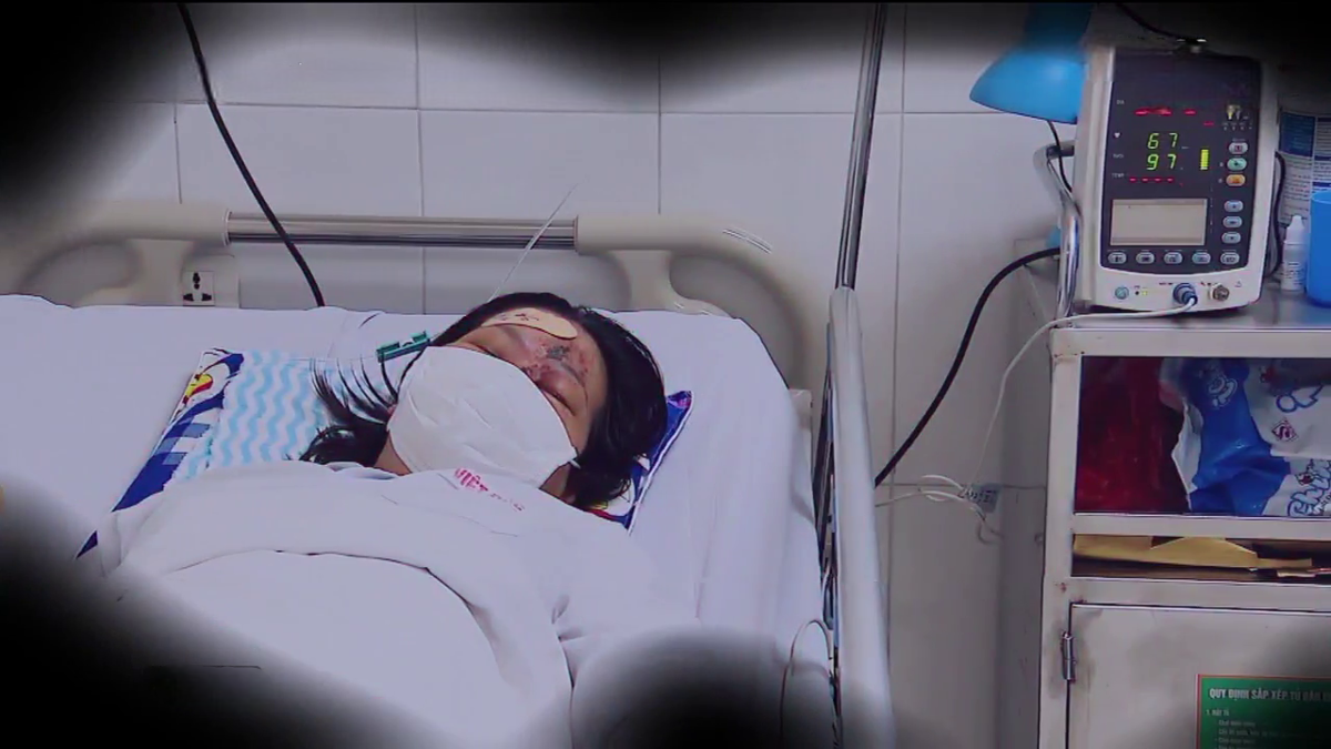 Mỗi năm Việt Nam có khoảng 250.000 ca phẫu thuật thẩm mỹ, với số ca biến chứng từ 25.000 - 35.000 trường hợp. Ảnh: VTV
