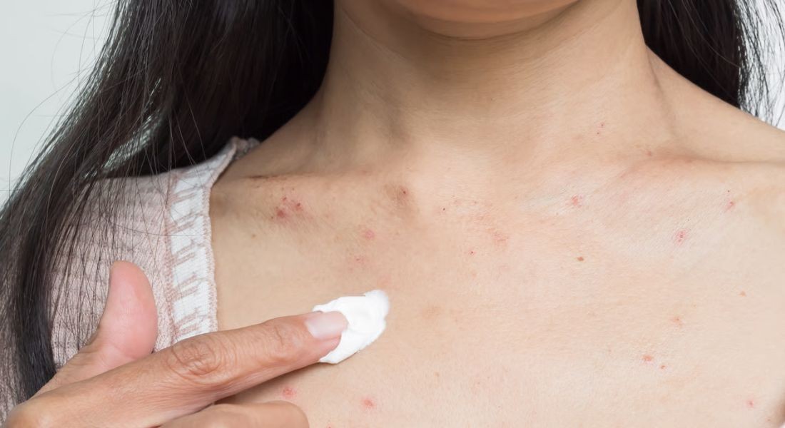 Ngành công nghiệp chăm sóc da chống ô nhiễm là một thị trường có giá trị lên tới hàng tỷ USD. Ảnh: The London Dermatology Centre