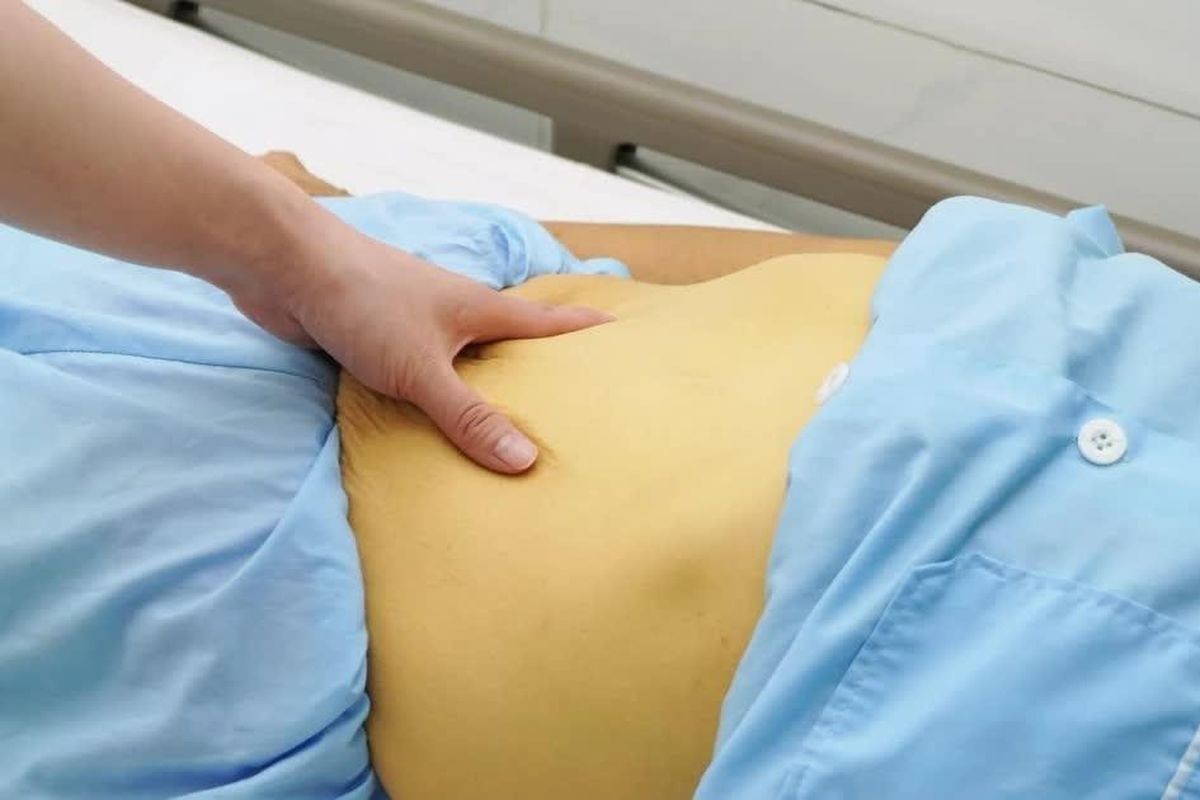 Bệnh nhân ghi nhận men gan tăng 30 lần, bilirubin tăng 41 lần giới hạn bình thường. Ảnh: Trung tâm Y tế khu vực Cẩm Khê