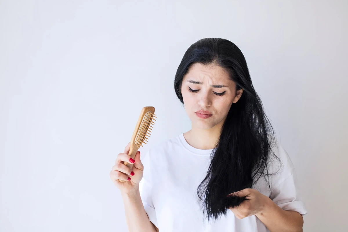 Tình trạng rụng tóc ngày càng phổ biến. Ảnh: iStock