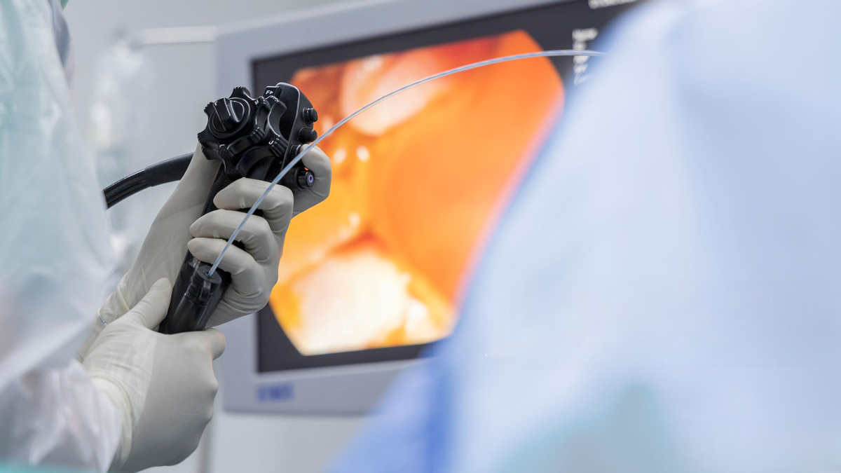 ERCP hiện được ứng dụng rộng rãi trong điều trị. Ảnh minh họa: Porrini