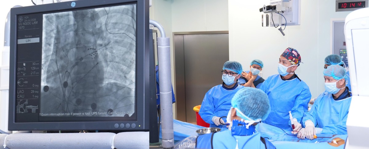 PFA là một trong những công nghệ điều trị rối loạn nhịp tim hiện đại nhất hiện nay. Ảnh: Bệnh viện Trung ương Quân đội 108